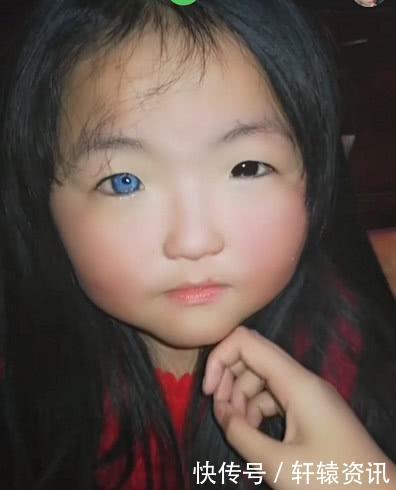 醫(yī)生回應7歲女孩天生異瞳，特殊眼神背后的科學解析，天生異瞳背后的科學解析，醫(yī)生回應特殊眼神之謎的真相（以7歲女孩為例）