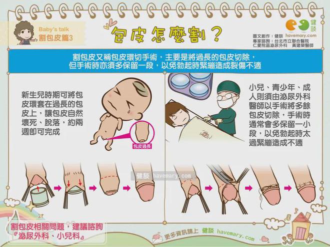 包莖手術(shù)痊愈時(shí)間探究，包莖手術(shù)痊愈時(shí)間解析